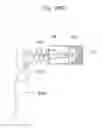 Fig. 156 - Apparatus for controlling flow in a bodily organ