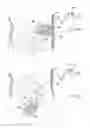 Fig. 157 - Apparatus for controlling flow in a bodily organ