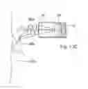 Fig. 16 - Apparatus for controlling flow in a bodily organ