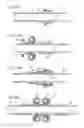 Fig. 172 - Apparatus for controlling flow in a bodily organ