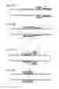 Fig. 175 - Apparatus for controlling flow in a bodily organ