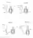 Fig. 178 - Apparatus for controlling flow in a bodily organ