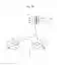 Fig. 49 - Apparatus for controlling flow in a bodily organ