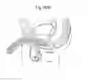 Fig. 60 - Apparatus for controlling flow in a bodily organ