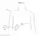 Fig. 64 - Apparatus for controlling flow in a bodily organ