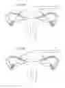 Fig. 66 - Apparatus for controlling flow in a bodily organ