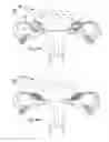 Fig. 69 - Apparatus for controlling flow in a bodily organ