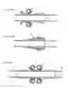 Fig. 81 - Apparatus for controlling flow in a bodily organ