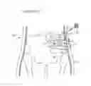 Fig. 82 - Apparatus for controlling flow in a bodily organ