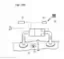 Fig. 87 - Apparatus for controlling flow in a bodily organ