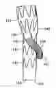 Fig. 01 - Branched vessel endoluminal device