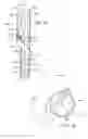 Fig. 07 - Branched vessel endoluminal device