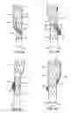 Fig. 08 - Branched vessel endoluminal device