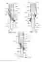 Fig. 11 - Branched vessel endoluminal device