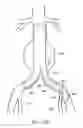 Fig. 16 - Branched vessel endoluminal device