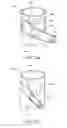 Fig. 21 - Branched vessel endoluminal device