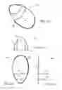 Fig. 22 - Branched vessel endoluminal device