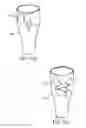 Fig. 29 - Branched vessel endoluminal device