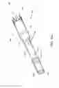 Fig. 39 - Branched vessel endoluminal device