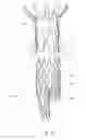 Fig. 10 - Low profile non-symmetrical stent