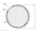 Fig. 01 - POST-LUMPECTOMY BREAST IMPLANT