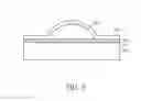 Fig. 04 - METHOD OF MANUFACTURING INTRAOCULAR LENS