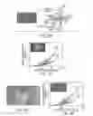 Fig. 03 - Vision correction with laser refractive index changes