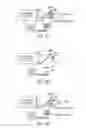 Fig. 08 - Vision correction with laser refractive index changes
