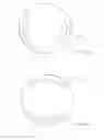 Fig. 11 - Vision correction with laser refractive index changes