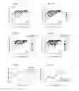 Fig. 16 - Vision correction with laser refractive index changes