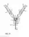 Fig. 11 - Double basket assembly for valve repair