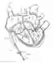 Fig. 01 - Systems and methods for treating a regurgitant heart valve