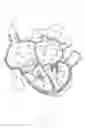 Fig. 03 - Systems and methods for treating a regurgitant heart valve