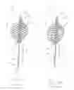 Fig. 05 - Systems and methods for treating a regurgitant heart valve