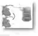 Fig. 06 - Systems and methods for treating a regurgitant heart valve