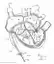 Fig. 17 - Systems and methods for treating a regurgitant heart valve