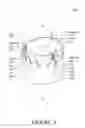 Fig. 05 - Valve component, frame component and prosthetic valve device including the same for implantation in a body lumen