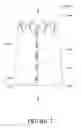 Fig. 08 - Valve component, frame component and prosthetic valve device including the same for implantation in a body lumen