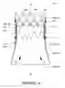 Fig. 10 - Valve component, frame component and prosthetic valve device including the same for implantation in a body lumen