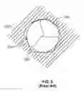 Fig. 03 - Transcatheter valve with paravalvular leak sealing ring