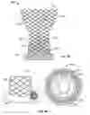 Fig. 04 - Transcatheter valve with paravalvular leak sealing ring