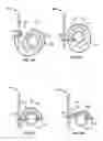 Fig. 08 - Transcatheter valve with paravalvular leak sealing ring