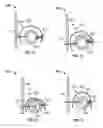 Fig. 14 - Transcatheter valve with paravalvular leak sealing ring