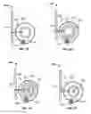 Fig. 15 - Transcatheter valve with paravalvular leak sealing ring