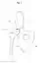 Fig. 02 - Buffer for femoral head and neck excision