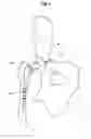 Fig. 03 - Buffer for femoral head and neck excision