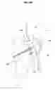 Fig. 05 - Buffer for femoral head and neck excision