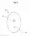 Fig. 12 - Buffer for femoral head and neck excision
