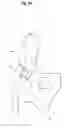 Fig. 13 - Buffer for femoral head and neck excision