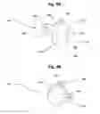 Fig. 15 - Buffer for femoral head and neck excision